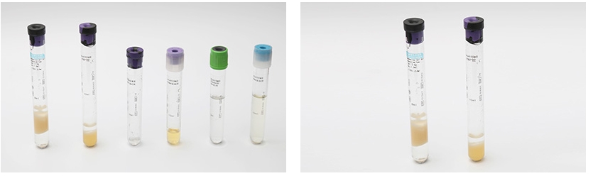 PRP Tube Assembly Line - Image 4