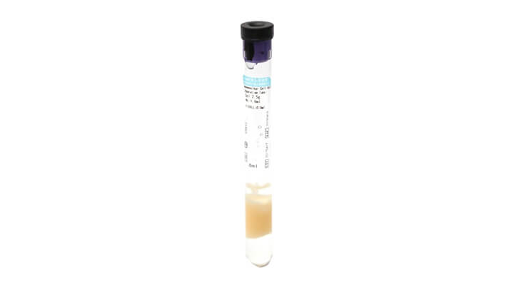 PRP Tube Assembly Line