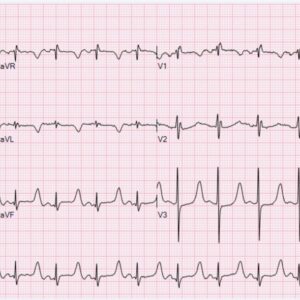 Veterinary Electrocardiograph